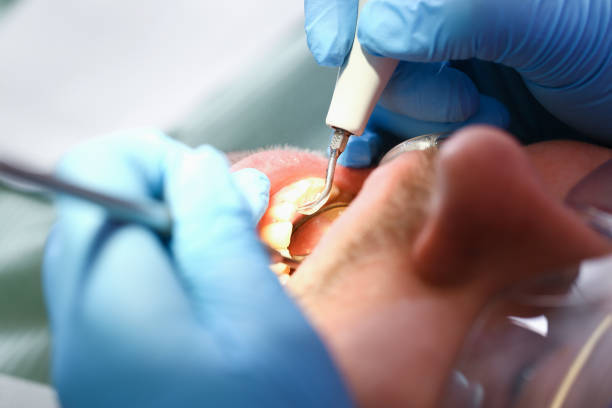 Best Urgent Care for Lost Fillings or Crowns in Lenoir, NC