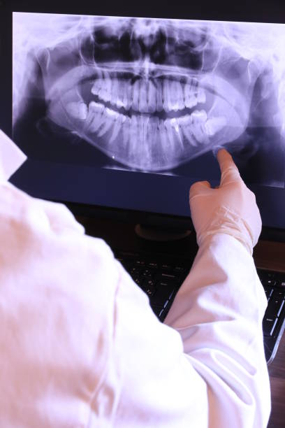 Best Emergency Tooth Extraction in Lenoir, NC