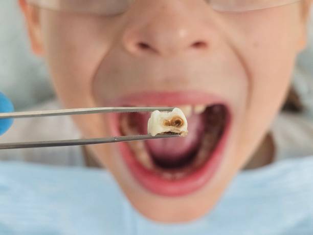 Best Emergency TMJ Treatment in Lenoir, NC